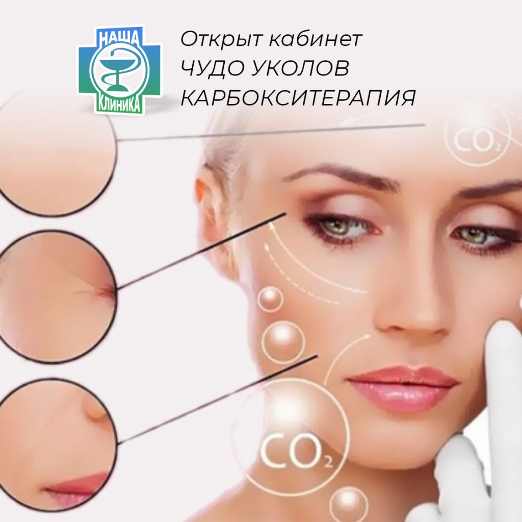Открыт кабинет чудо уколов Карбокситерапия